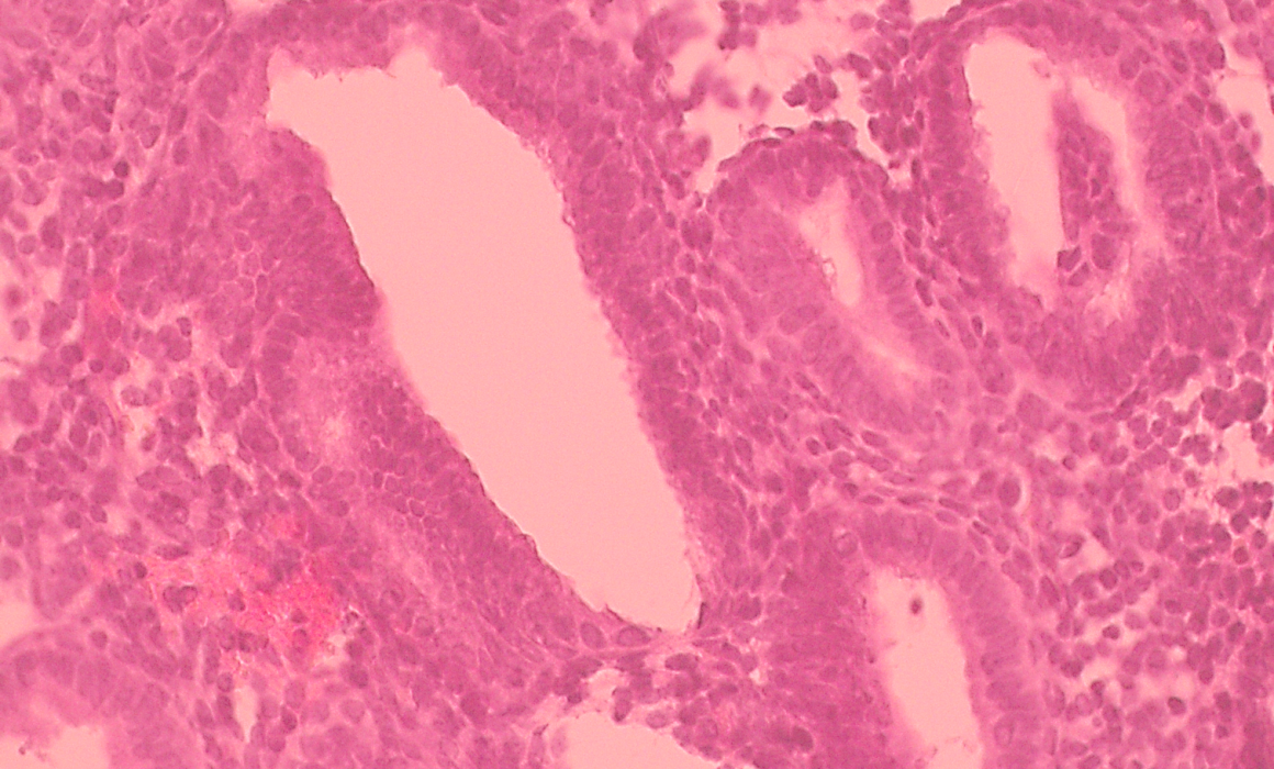Tinción de hematoxilina-eosina de las células del endometrio al microscopio óptico 10X.